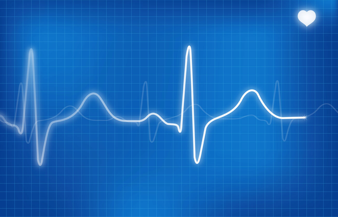 Electrocardiogram